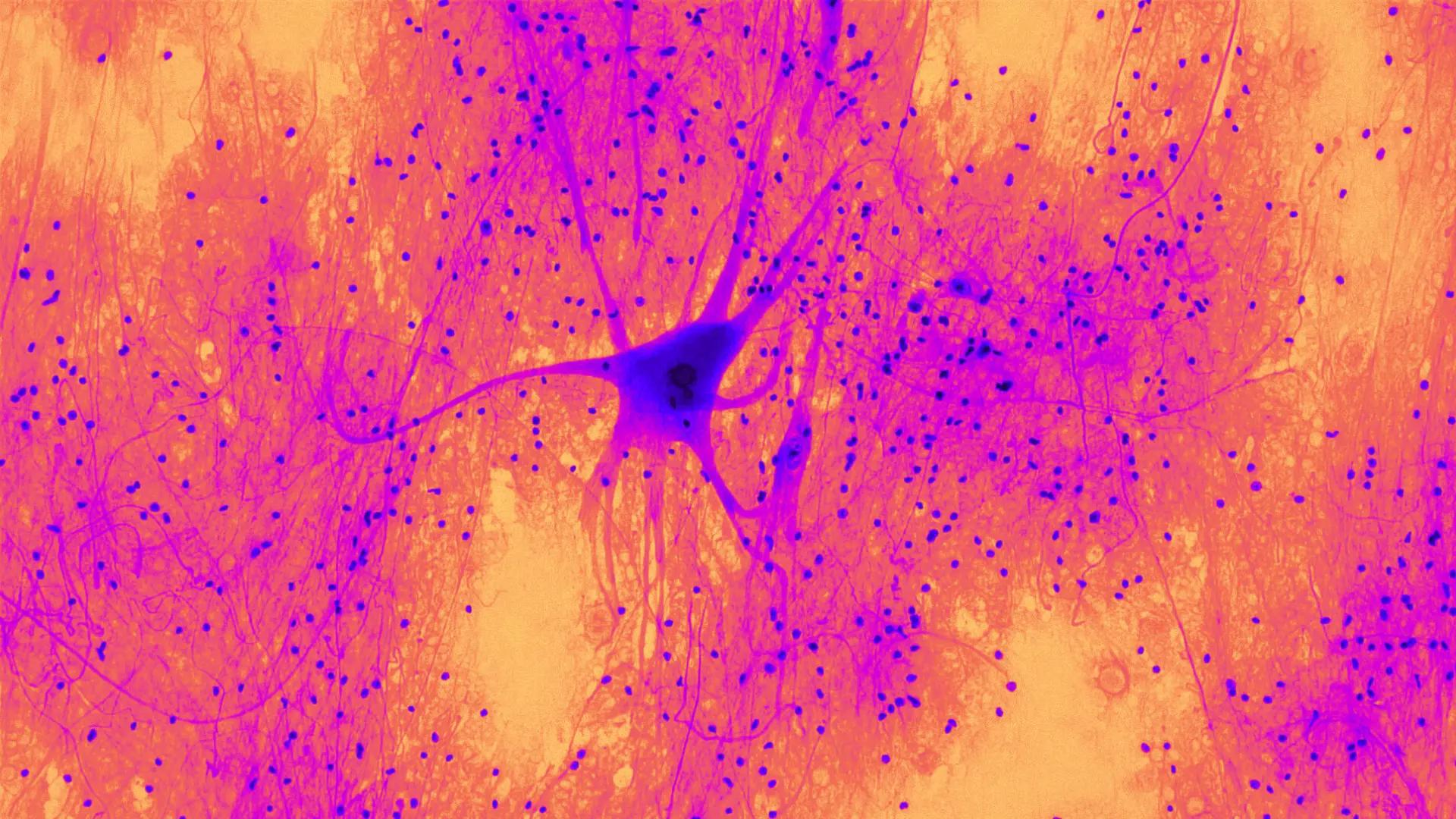 ChatGPT : quel impact sur nos capacités cognitives ?